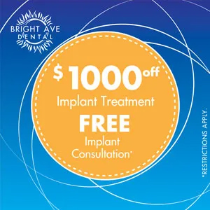 The image is a promotional graphic for a dental implant treatment, offering a  1000 discount on the consultation fee. It features a circular design with a blue background and a white border, containing text and a yellow starburst shape that reads  Bright Avenue Dental.
