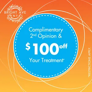 The image displays a graphic with a white background and features text that reads  COMPLIMENTARY 2ND OPINION    100 OFF TREATMENT.  Below this, there s a button labeled  BOOK YOUR APPOINTMENT  with an asterisk symbol, indicating terms and conditions apply. The style of the image is promotional and appears to be an advertisement for dental services.