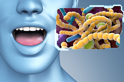 An image depicts a human mouth with an open mouth, featuring a close-up of bacterial cells or microorganisms against a blue background.