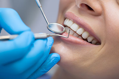 A dental professional performing a teeth cleaning procedure on a patient with a smile.