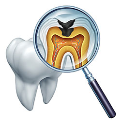 The image shows a magnified view of a human tooth with its root system and an open cross-section revealing the pulp chamber, where a small black object resembles a fish. A magnifying glass is placed over the tooth, highlighting this detail.