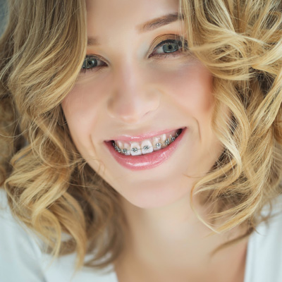 A woman with a bright smile, wearing braces and a white top, against a light background.