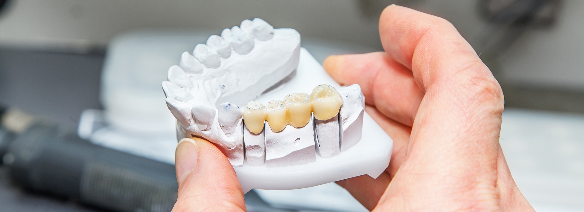 The image shows a person holding a 3D printed model of a human mouth with teeth.