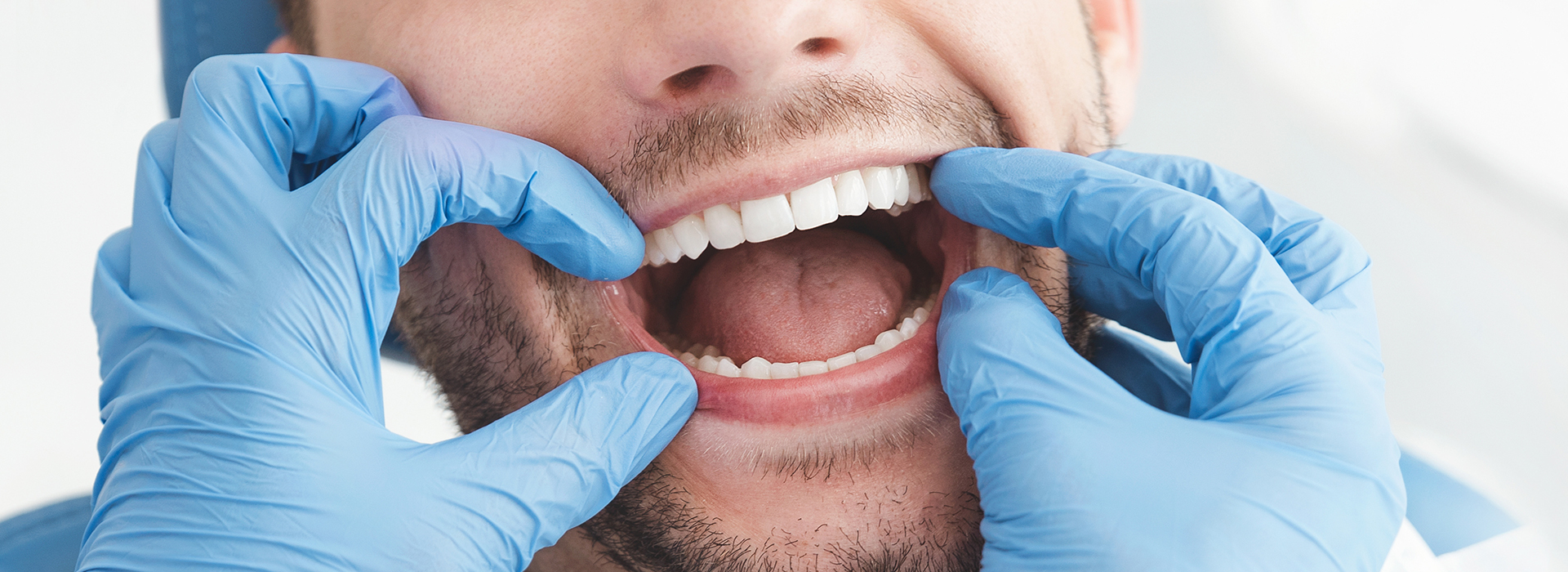 Man with open mouth and dental tools, likely a dentist.