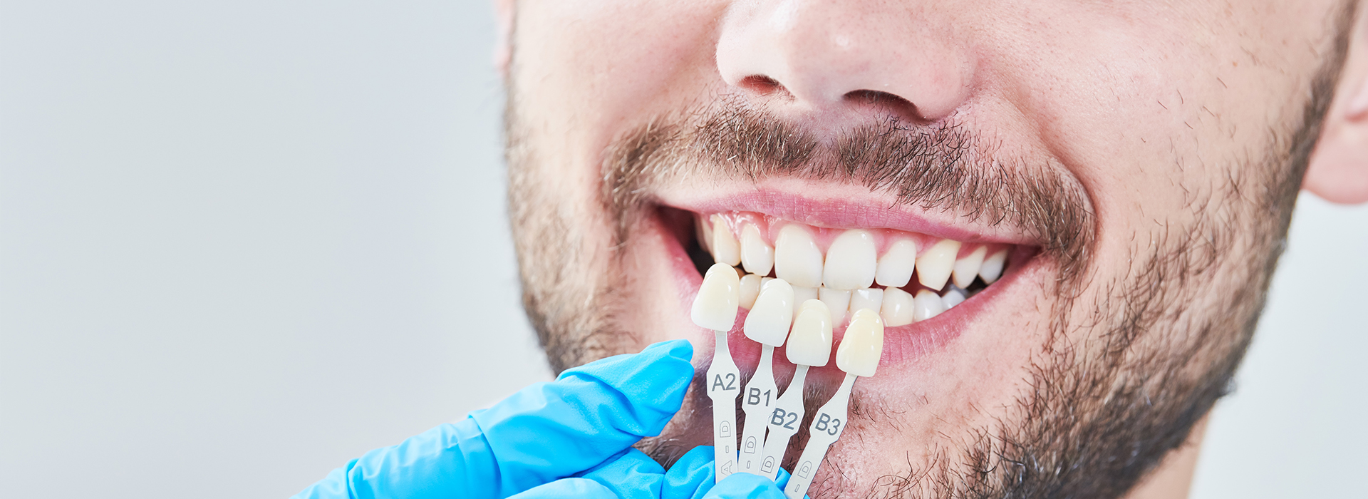 The image shows a man with a toothy smile, wearing a blue surgical mask and holding a dental implant in his hand.