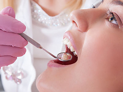 The image depicts a dental professional performing a procedure on a patient s mouth, with the patient wearing a purple surgical mask and having their teeth worked on.