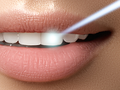 An advertisement featuring a close-up of a person s lips and teeth, with a focus on oral hygiene or cosmetic dental care.