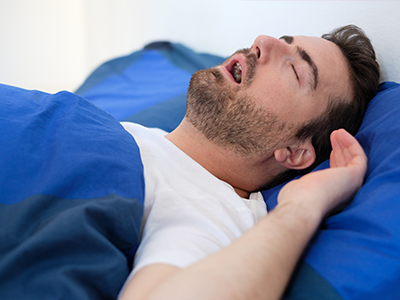 A man sleeping on a bed with his mouth open.